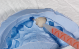 Внесение Luxatemp Fluorescence